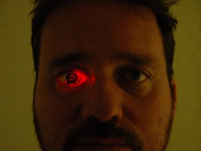Rob Spence, Canadian filmmaker, created a prosthetic eye for himself with a built-in video camera after losing his eye in a shotgun accident.
