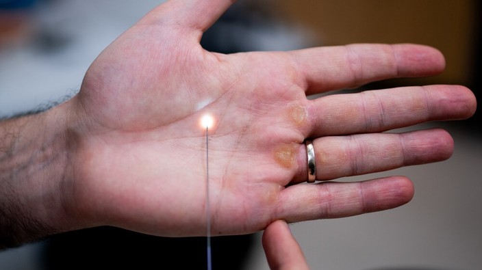 How a really tiny camera could revolutionize stroke treatment