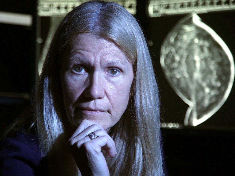 Dr. Jean Seely, head of breast imaging at The Ottawa Hospital, says the  Canadian Task Force on Preventative Health Care continued to rely on outdated research on breast cancer screening.