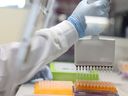 The Ottawa wastewater surveillance program tests for influenza, RSV and other diseases in addition to the virus that causes COVID-19.