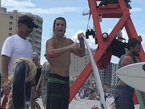 Surfer Frank O'Rourke shared this photo on Instagram of himself after he was attacked by a shark in Florida over the weekend.