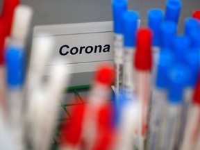 Plastic vials containing tests for the coronavirus are pictured at a medical laboratory.