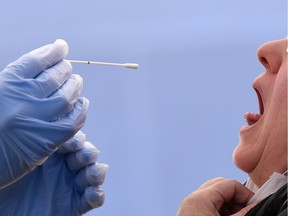 A medical employee collects a swab.