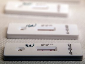 A view shows an antibody rapid serological test for COVID-19 following a finger prick blood sample, on May 6, 2020 at the Tor Vergata Covid hospital in Rome.