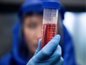 A scientist displays a test sample during diagnostic.