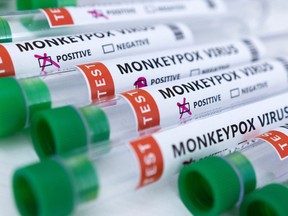 Test tubes labelled "Monkeypox virus positive and negative" are seen in this illustration taken May 23, 2022.