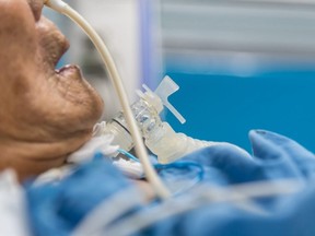 A patient uses a ventilator for breathing help on a bed in the hospital.