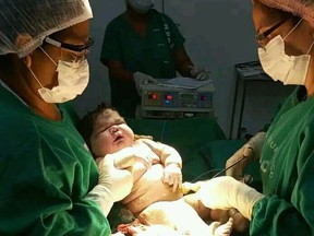 Cleidiane Santos dos Santos, 27, gave birth to a 16-pound baby boy at Hospital Padre Colombo in Parintins, Brazil, on Jan. 18, 2023.