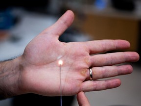 Dr. Robert Fahed, interventional neuroradiologist and stroke neurologist at The Ottawa Hospital, illustrates the size of the MicroAngioScope by holding it against his hand.