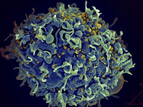 Electron microscope image of human T cell under attack by HIV