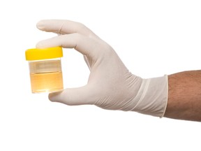 Some U.S. states having adopted legislation preventing employers from drug testing prospective workers. /