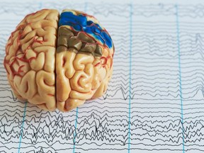 “We find no evidence to support the presumption that cannabis consumption leads to a decline in neurocognitive ability.” /