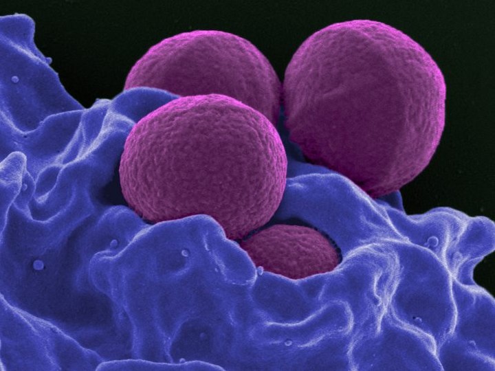  FILE: Methicillin-Resistant Staphylococcus aureus Scanning electron micrograph of a human neutrophil ingesting MRSA. /