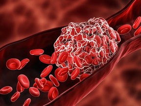 Thromboembolic complications occurred in three per cent of THC-positive patients versus 1.7 per cent of THC-negative patients. /