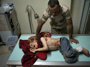 Opposition fighter stands over Ahmad Jabir, who was hurt in July with some of his family by a shell in Al-Bara, in Syria’s northwestern province Idlib.­ (AFP/GETTY IMAGES)