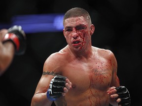 Diego Sanchez may have lost his fight against top lightweight contender Gilbert Melendez at UFC 166 on Saturday, but his unbelievable performance earned him an entirely new level of respect.