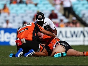 Liam Fulton of the NRL's Wests Tigers has suffered four concussions in just six games this season.  (Photo by Mark Nolan/Getty Images)