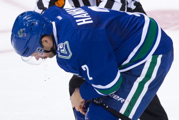 Vancouver Canucks' Dan Hamhuis is helped off the ice by referee Ian Walsh after being struck in the mouth by the puck during third period NHL hockey action against the New York Rangers, in Vancouver, on Wednesday, Dec. 9, 2015. THE CANADIAN PRESS/Darryl Dyck