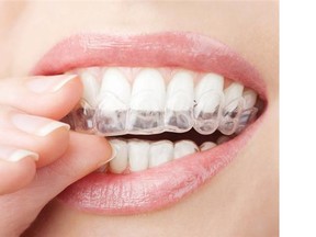 According to the makers of Crest products, some teeth-whitening trays are pre-filled with a peroxide-based whitening agent, while others come with syringes of gel that can be dispensed as needed by the user.