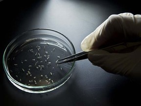 A researcher collects larvae of Aedes aegypti mosquitos in a petri dish at a lab of the Institute of Biomedical Sciences of the Sao Paulo University, on January 8, 2016 in Sao Paulo, Brazil.