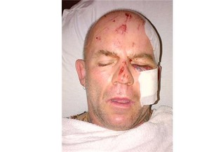 Surrey RCMP are requesting the public’s assistance in locating this man, who walked away from Surrey Memorial Hospital.