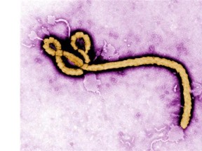 This undated colorized transmission electron micrograph file image made available by the CDC shows an Ebola virus virion.