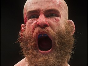 Garreth McLellan, of South Africa, reacts after his fight against Alessio Di Chirico, of Italy, during a middleweight bout during a UFC Fight Night event in Vancouver on Saturday, August 27, 2016.