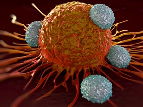 T-cells attacking cancer cell, microscopic photo.