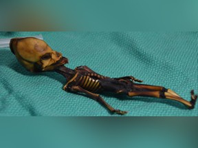 The Atacama skeleton, or Ata, named after the Chilean desert where the remains were found.
