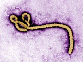 FILE - In this undated colorized transmission electron micrograph file image made available by the CDC shows an Ebola virus virion. Congo's Ebola outbreak has spread to a city, the capital of the northwestern Equateur province, a worrying shift as the risk of infection is more easily passed on in densely populated urban areas.