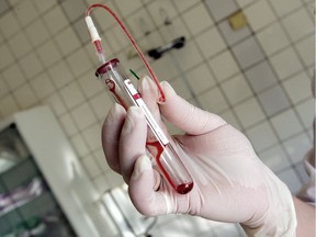 This file picture taken in June 2006 shows a nurse holding a test-tube with HIV-positive blood in an infectious diseases hospital.