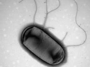 An E. coli outbreak has made five people in British Columbia sick and the provincial centre for disease control is warning consumers to throw away or return Little Qualicum Cheeseworks Qualicum Spice cheese. Electron micrograph image of E.coli.
