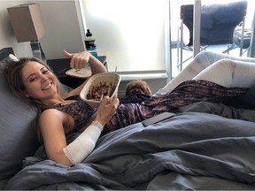 Freelance model Robyn-lee Jansen is recovering after suffering second-degree burns to her legs during a Vancouver photo shoot.
