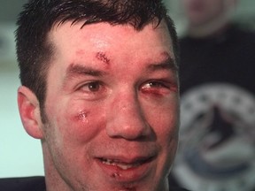 Former Canucks forward Scott Walker in a 1998 photo, showing the damage after taking a sucker punch from Phoenix Coyotes defenceman Michel Petit. After four years on the Canucks' player development staff, he's joining the Arizona Coyotes.