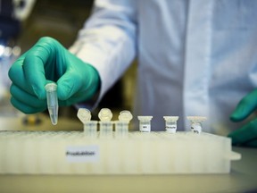 Employee Philipp Hoffmann, of German biopharmaceutical company CureVac, demonstrates research workflow on a vaccine for the coronavirus (COVID-19) disease at a laboratory in Tuebingen, Germany, March 12, 2020. Picture taken on March 12, 2020.