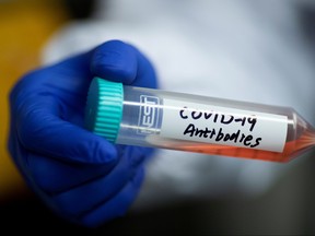 Scientist Linqi Zhang shows a tube with a solution containing COVID-19 antibodies in his lab where he works on research into novel coronavirus disease (COVID-19) antibodies for possible use in a drug at Tsinghua University's Research Center for Public Health in Beijing, China, March 30, 2020. (REUTERS/Thomas Peter)