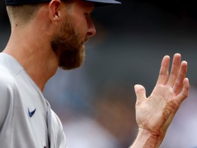 Pitcher Chris Sale of the Boston Red Sox checks out the fractured pinky finger on his throwing hand after getting hit by a line drive during a July 17, 2022 American League game against the New York Yankees at Yankee Stadium.