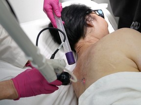 Kim Phuc receives a laser treatment by Dr. Jill Waibel at the Miami Dermatology and Laser Institute, Tuesday, June 28, 2022, in Miami. Phuc was the subject 50 years ago of the Pulitzer Prize-winning "Napalm Girl" photo by retired AP photographer Nick Ut. She has been treated since 2015 pro bono at the institute for scars suffered in the June 8, 1972, firebombing of her village during the Vietnam War.