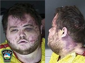 This handout photo released by the Colorado Springs Police Department on Wednesday, Nov. 23, 2022, shows the mugshot of Anderson Lee Aldrich, suspect in the Club Q massacre. Aldrich was injured while being subdued during the mass shooting.