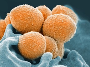 Bacteria have evolved to become more aggressive and resistant to antibiotics. Photo: Associated Press.