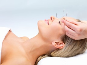 Acupuncture is a treatment composed of activating specific locations - or acupoints - on the body, commonly with fine needles.
