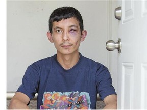 Jalal Soltani claims three strangers knocked on his door early Friday morning and jumped him, beating him badly after he answered the door. Police did not respond until m ore than four hours after his 911 call.