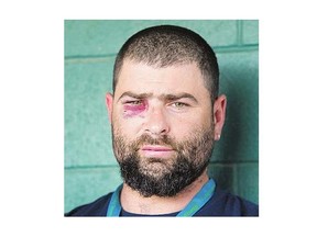 Luke Peters was punched in the face during a brawl.