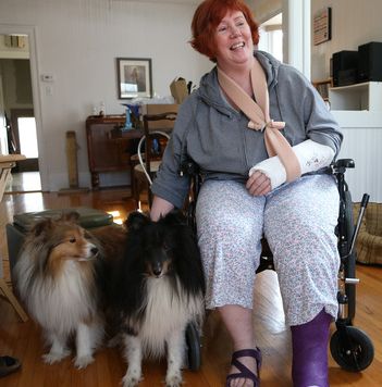 Kelly Donald is seen here with her two shelties Aiden and Percy and her four broken bones after a dog ran her down at the Avalon dog park in Saskatoon on March 15, 2015.
