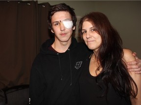 18-year-old Brennan Schwab, pictured with mom Nicole, was on his way to a friend's house when a man allegedly pulled out what police told him was a shotgun, pointed it at him and pulled the trigger. Now, he's speaking out to make members of the public know he didn't deserve to be attacked, calling the incident, "totally random" in nature. (Morgan Modjeski/The Saskatoon StarPhoenix).