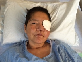 Marlene Bird, shown here recovering in St. Paul's Hospital after she was attacked and set on fire in Prince Albert