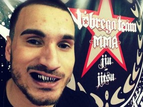 Joao Carvalho, a mixed martial arts fighter from Portugal, died after being hospitalized with injuries from a fight