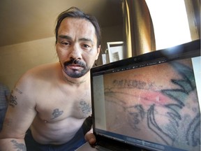 Dion Waniandy displays photos of the soreness he had on his shoulder on day 3 after he was tasered in his home last Wednesday by Saskatoon Police who were given the wrong apartment number for a call, July 4, 2016.