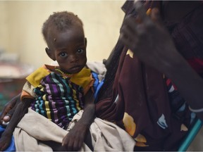 A severely malnourished one-year-old child sits on her mother's lap at a Doctors Without Borders clinic in Leer town, South Sudan on Tuesday Dec. 15,  2015.