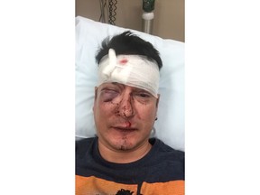 Eugene Grosh says he was beaten at a bar in Saskatoon on Friday.